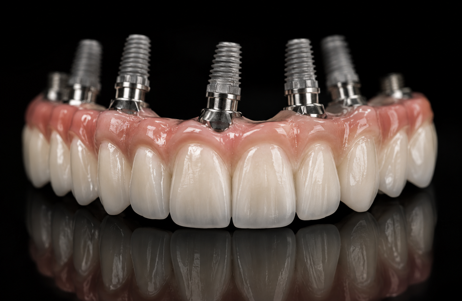 Implant Prostheses
